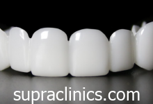 تجربتي مع ابتسامة هوليود المتحركة