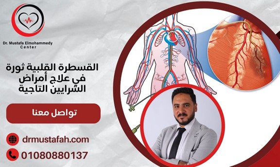 القسطرة التشخيصية