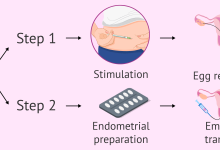 عملية الحقن المجهري خطوة بخطوة - من التنشيط حتى الحمل