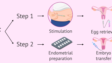 عملية الحقن المجهري خطوة بخطوة - من التنشيط حتى الحمل