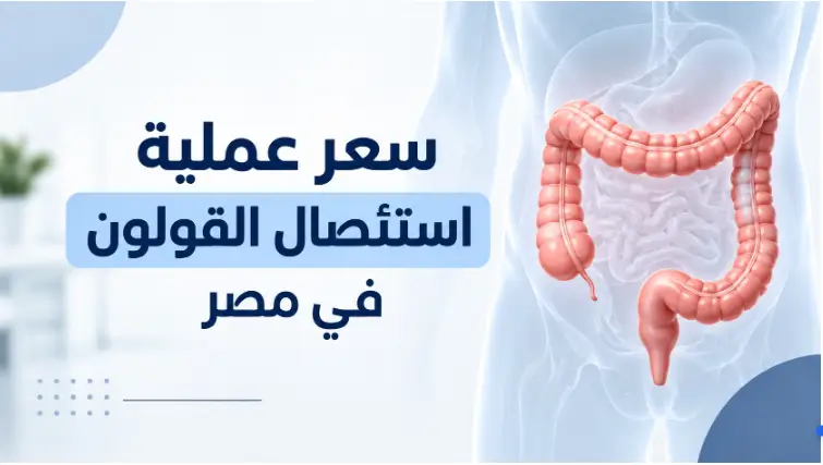 سعر عملية استئصال القولون في مصر بالمنظار والجراحة